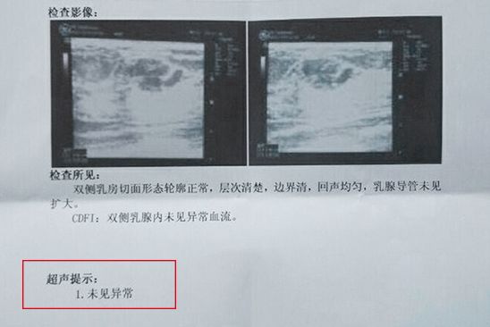 澳门威斯尼斯wns675入口53岁王菲真敢! 与王家卫曝光躺地上凹姿势秀S曲线任(图11)